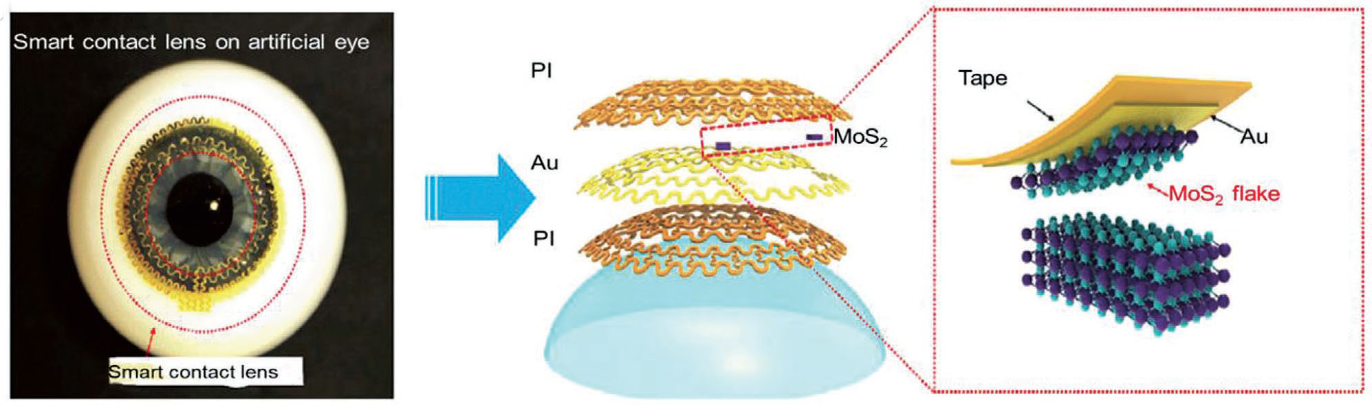 Ultrathin MoS2 transistor-based smart contact lens to monitor glucose levels