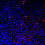 fluorescent-labeled_microparticles