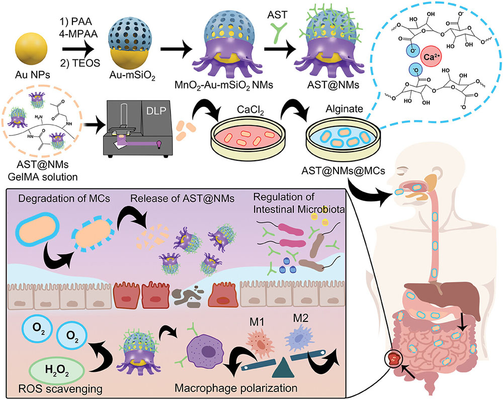 Schematic illustration of the fabrication process of AST@NMs@MCs and anti-inflammatory therapy for DSS-induced IBD