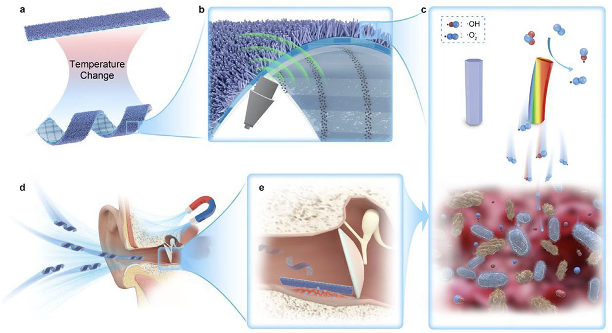 Magnetically actuated shape-morphing soft microrobot for localized antibacterial therapy