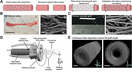 Manufacturing customizable fibrous vascular grafts.