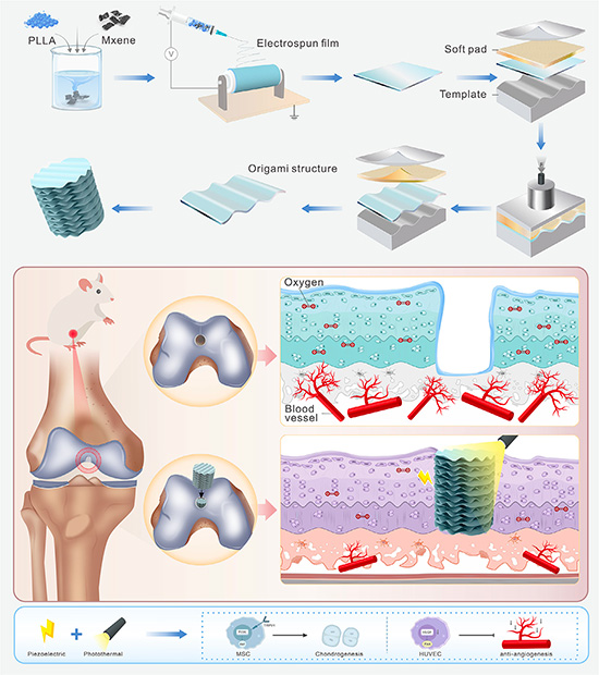 Construction of Origami-Structured PLLA/MXene Piezoelectric-Photothermal Scaffold and Its Dual Regulatory Mechanism for Cartilage Regeneration.