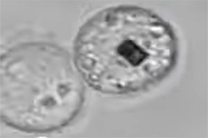 Cell division of a HeLa cell with a sensor chip inside